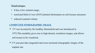 47
Disadvantages.
• It has a low contrast range,
• restricted field of view (FOV),limited information on soft tiossue structures
• reduced scanned volume
COMPUTED TOMOGRAPHIC IMAGE
 CT was invented by Sir Godfrey Hounsfield and was introduced in
1972.This modality gives rise to high-density resolution images, and allows
soft tissues to be visualized.
 CT scan provides tangential and cross-sectional tomographic images of the
implant site
 