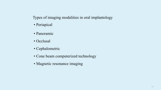 6 4
Types of imaging modalities in oral implantology
• Periapical
• Panoramic
• Occlusal
• Cephalometric
• Cone beam computerized technology
• Magnetic resonance imaging
 