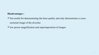 7 0
Disadvantages :
Not useful for demonstrating the bone quality and only demonstrates a cross-
sectional image of the alveolus
low power magnification and superimposition of images
 