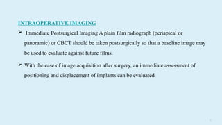 7 7
INTRAOPERATIVE IMAGING
 Immediate Postsurgical Imaging A plain film radiograph (periapical or
panoramic) or CBCT should be taken postsurgically so that a baseline image may
be used to evaluate against future films.
 With the ease of image acquisition after surgery, an immediate assessment of
positioning and displacement of implants can be evaluated.
 