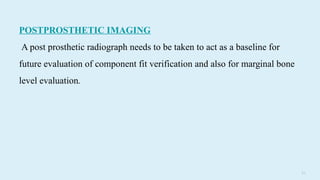 7 9
POSTPROSTHETIC IMAGING
A post prosthetic radiograph needs to be taken to act as a baseline for
future evaluation of component fit verification and also for marginal bone
level evaluation.
 