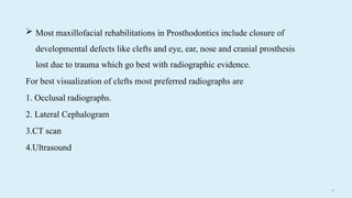 8 3
 Most maxillofacial rehabilitations in Prosthodontics include closure of
developmental defects like clefts and eye, ear, nose and cranial prosthesis
lost due to trauma which go best with radiographic evidence.
For best visualization of clefts most preferred radiographs are
1. Occlusal radiographs.
2. Lateral Cephalogram
3.CT scan
4.Ultrasound
 