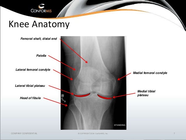 Imaging technologist training the osteoarthritic knee 2014
