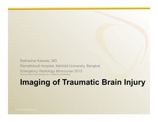 Rathachai Kaewlai, MD 
Ramathibodi Hospital, Mahidol University, Bangkok 
Emergency Radiology Minicourse 2013 
Slides available at RiTradiology.com or Slideshare.net/rathachai 
Imaging of Traumatic Brain Injury 
www.RiTradiology.com 
 