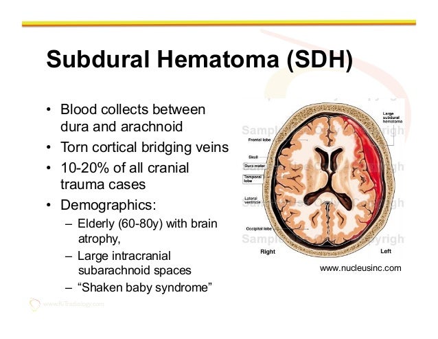 Imaging of the traumatic brain injury by Rathachai Kaewlai, MD cerebral cortex layer diagram 