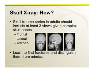 www.RiTradiology.com	

Skull X-ray: How?
•  Skull trauma series in adults should
include at least 3 views given complex
skull bones
– Frontal
– Lateral
– Towne’s
•  Learn to find fractures and distinguish
them from mimics
 