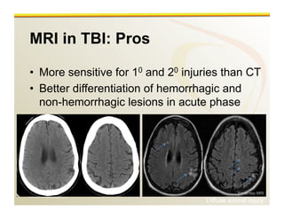www.RiTradiology.com	

MRI in TBI: Pros
•  More sensitive for 10 and 20 injuries than CT
•  Better differentiation of hemorrhagic and
non-hemorrhagic lesions in acute phase
Same-day MRI
Diffuse axonal injury
 