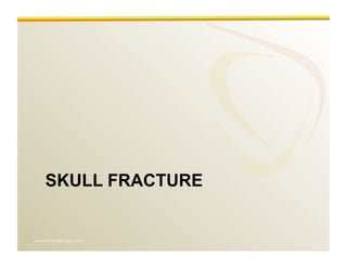 www.RiTradiology.com	

SKULL FRACTURE
 