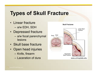 www.RiTradiology.com	

Types of Skull Fracture
•  Linear fracture
–  a/w EDH, SDH
•  Depressed fracture
–  a/w focal parenchymal
lesions
•  Skull base fracture
•  Open head injuries
–  Knife, firearm
–  Laceration of dura www.uchospitals.edu
 