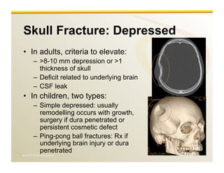 www.RiTradiology.com	

Skull Fracture: Depressed
•  In adults, criteria to elevate:
–  >8-10 mm depression or >1
thickness of skull
–  Deficit related to underlying brain
–  CSF leak
•  In children, two types:
–  Simple depressed: usually
remodelling occurs with growth,
surgery if dura penetrated or
persistent cosmetic defect
–  Ping-pong ball fractures: Rx if
underlying brain injury or dura
penetrated
 