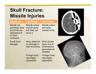 www.RiTradiology.com	

Skull Fracture:
Missile Injuries
Depressed Penetrating Perforating
Missile not
penetrate skull
but produces
depressed fx
or brain
contusion
Missile enters
cranial cavity
but does not
leave it
Missile enters
and exits
cranial cavity
Focal brain
damage
Injury depends
on damage to
vital structures
Most severe
injury due to
shockwaves
generated by
missiles
Foreign body,
meningitis,
abscesses
Foreign body,
meningitis,
abscesses
 