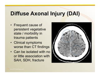 www.RiTradiology.com	

Diffuse Axonal Injury (DAI)
•  Frequent cause of
persistent vegetative
state / morbidity in
trauma patients
•  Clinical symptoms
worse than CT findings
•  Can be isolated with no
or little association with
SAH, SDH, fracture
 