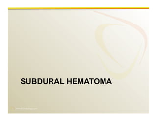 www.RiTradiology.com	

SUBDURAL HEMATOMA
 