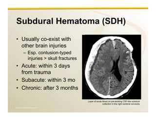 www.RiTradiology.com	

Subdural Hematoma (SDH)
•  Usually co-exist with
other brain injuries
–  Esp. contusion-typed
injuries > skull fractures
•  Acute: within 3 days
from trauma
•  Subacute: within 3 mo
•  Chronic: after 3 months
Layer of acute blood on pre-existing CSF-like subdural
collection in the right cerebral convexity
 