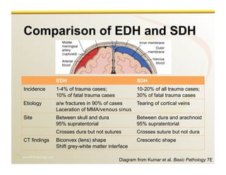 www.RiTradiology.com	

Comparison of EDH and SDH
EDH SDH
Incidence 1-4% of trauma cases;
10% of fatal trauma cases
10-20% of all trauma cases;
30% of fatal trauma cases
Etiology a/w fractures in 90% of cases
Laceration of MMA/venous sinus
Tearing of cortical veins
Site Between skull and dura
95% supratentorial
Between dura and arachnoid
95% supratentorial
Crosses dura but not sutures Crosses suture but not dura
CT findings Biconvex (lens) shape
Shift grey-white matter interface
Crescentic shape
Diagram from Kumar et al. Basic Pathology 7E
 