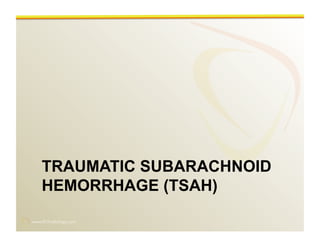 www.RiTradiology.com	

TRAUMATIC SUBARACHNOID
HEMORRHAGE (TSAH)
 