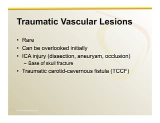 www.RiTradiology.com	

Traumatic Vascular Lesions
•  Rare
•  Can be overlooked initially
•  ICA injury (dissection, aneurysm, occlusion)
–  Base of skull fracture
•  Traumatic carotid-cavernous fistula (TCCF)
 