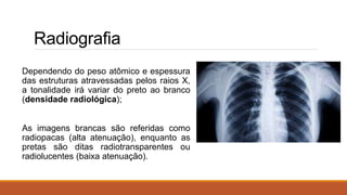 Radiografia
Dependendo do peso atômico e espessura
das estruturas atravessadas pelos raios X,
a tonalidade irá variar do preto ao branco
(densidade radiológica);
As imagens brancas são referidas como
radiopacas (alta atenuação), enquanto as
pretas são ditas radiotransparentes ou
radiolucentes (baixa atenuação).
 