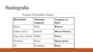 Radiografia
Densidade Absorção
corporal
Imagem no
filme
Metal Total Branca
Cálcio (osso) Grande Menos branca
Água (tec. moles) Média Cinza
Gordura Pouca Quase preta
Ar Nenhuma Preta
Existem 5 densidades básicas:
 