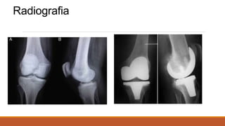 Radiografia
 