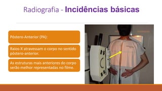 Radiografia - Incidências básicas
Póstero-Anterior (PA):
Raios-X atravessam o corpo no sentido
póstero-anterior.
As estruturas mais anteriores do corpo
serão melhor representadas no filme.
 