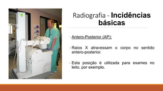 Radiografia - Incidências
básicas
◦ Antero-Posterior (AP):
- Raios X atravessam o corpo no sentido
antero-posterior.
- Esta posição é utilizada para exames no
leito, por exemplo.
 