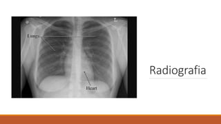 Radiografia
 