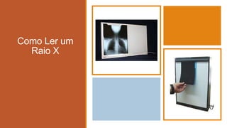 Como Ler um
Raio X
 