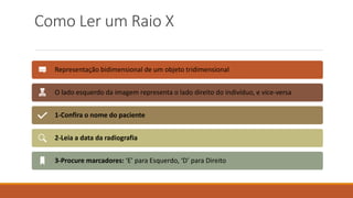 Como Ler um Raio X
Representação bidimensional de um objeto tridimensional
O lado esquerdo da imagem representa o lado direito do indivíduo, e vice-versa
1-Confira o nome do paciente
2-Leia a data da radiografia
3-Procure marcadores: ‘E’ para Esquerdo, ‘D’ para Direito
 