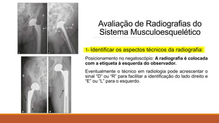 Avaliação de Radiografias do
Sistema Musculoesquelético
1- Identificar os aspectos técnicos da radiografia:
Posicionamento no negatoscópio: A radiografia é colocada
com a etiqueta à esquerda do observador.
Eventualmente o técnico em radiologia pode acrescentar o
sinal “D” ou “R” para facilitar a identificação do lado direito e
“E” ou “L” para o esquerdo.
 