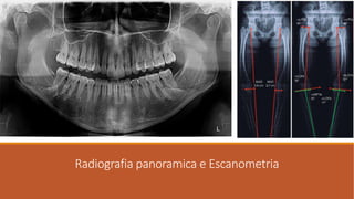 Radiografia panoramica e Escanometria
 