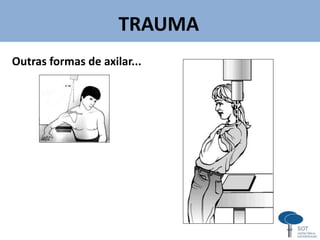 TRAUMA
v
Outras formas de axilar...
 
