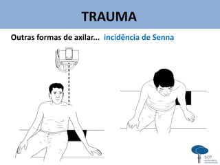 TRAUMA
v
Outras formas de axilar... incidência de Senna
 