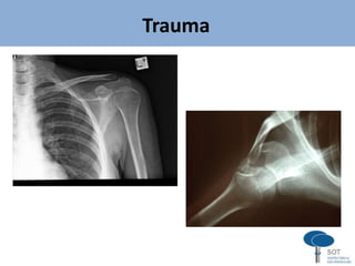 Trauma
 