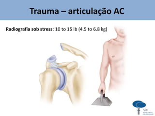 Radiografia sob stress: 10 to 15 lb (4.5 to 6.8 kg)
Trauma – articulação AC
 