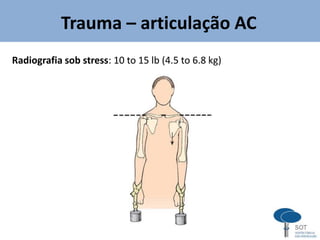 Radiografia sob stress: 10 to 15 lb (4.5 to 6.8 kg)
Trauma – articulação AC
 
