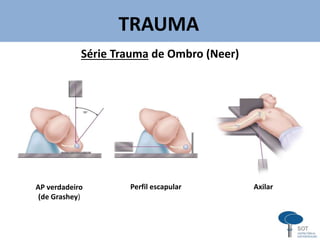 TRAUMA
Série Trauma de Ombro (Neer)
v
AP verdadeiro
(de Grashey)
Perfil escapular Axilar
 