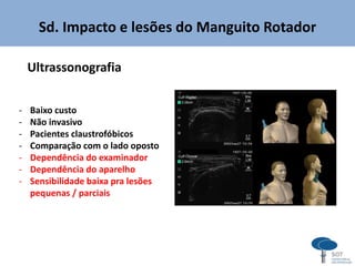 Sd. Impacto e lesões do Manguito Rotador
Ultrassonografia
- Baixo custo
- Não invasivo
- Pacientes claustrofóbicos
- Comparação com o lado oposto
- Dependência do examinador
- Dependência do aparelho
- Sensibilidade baixa pra lesões
pequenas / parciais
 