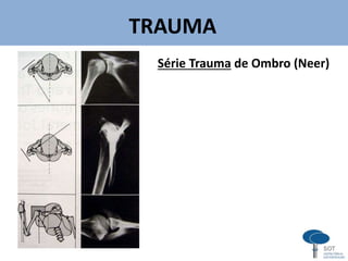 TRAUMA
Série Trauma de Ombro (Neer)
v
 