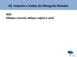 Sd. Impacto e lesões do Manguito Rotador
IRM:
Oblíqua coronal; oblíqua sagital e axial
 