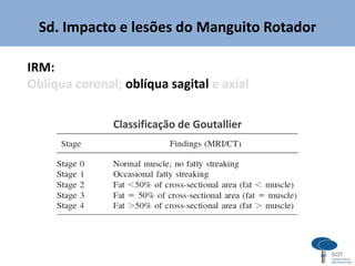 Sd. Impacto e lesões do Manguito Rotador
IRM:
Oblíqua coronal; oblíqua sagital e axial
Classificação de Goutallier
 