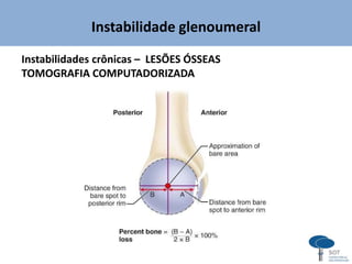 Instabilidade glenoumeral
Instabilidades crônicas – LESÕES ÓSSEAS
TOMOGRAFIA COMPUTADORIZADA
 