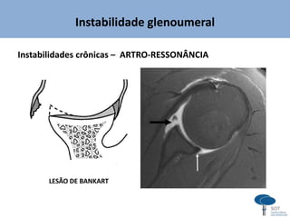 Instabilidade glenoumeral
Instabilidades crônicas – ARTRO-RESSONÂNCIA
LESÃO DE BANKART
 