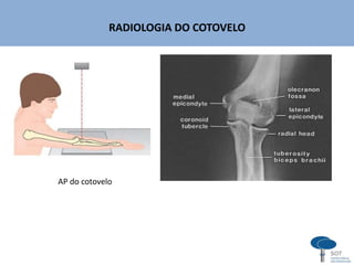 RADIOLOGIA DO COTOVELO
AP do cotovelo
 