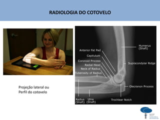 RADIOLOGIA DO COTOVELO
Projeção lateral ou
Perfil do cotovelo
 