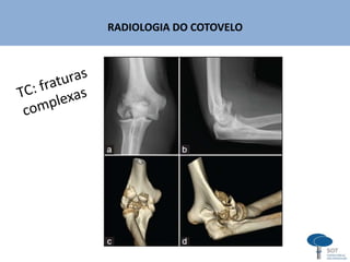 RADIOLOGIA DO COTOVELO
 