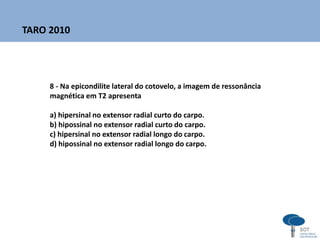 8 - Na epicondilite lateral do cotovelo, a imagem de ressonância
magnética em T2 apresenta
a) hipersinal no extensor radial curto do carpo.
b) hipossinal no extensor radial curto do carpo.
c) hipersinal no extensor radial longo do carpo.
d) hipossinal no extensor radial longo do carpo.
TARO 2010
 
