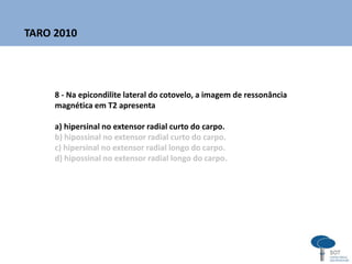 8 - Na epicondilite lateral do cotovelo, a imagem de ressonância
magnética em T2 apresenta
a) hipersinal no extensor radial curto do carpo.
b) hipossinal no extensor radial curto do carpo.
c) hipersinal no extensor radial longo do carpo.
d) hipossinal no extensor radial longo do carpo.
TARO 2010
 