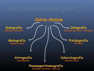 RX com contraste (Cont.)
                                 Outras técnicas

Sialografia                                                               Celiografia
(Glândulas salivares)                                              (Cavidade peritoneal, diafragma)




    Mielografia                                                         Fistulografia
     (Espinal medula)                                                          (Fístulas)




           Artrografia                                           Colecistografia
              (Articulações)                                        (Vesícula biliar)


                           Pneumoperitoneografia
                               (Cavidade peritoneal, vísceras)
 