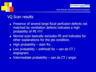 Imaging of Pulmonary Embolism | PDF